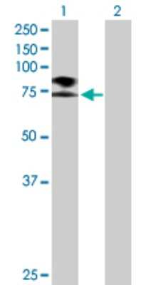 Western Blot: epithelial Sodium Channel beta Antibody [H00006338-B01P] - Analysis of SCNN1B expression in transfected 293T cell line by SCNN1B polyclonal antibody.  Lane 1: SCNN1B transfected lysate(72.60 KDa). Lane 2: Non-transfected lysate.