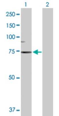 Western Blot: epithelial Sodium Channel beta Antibody [H00006338-D01P] - Analysis of SCNN1B expression in transfected 293T cell line by SCNN1B polyclonal antibody.Lane 1: SCNN1B transfected lysate(72.60 KDa).Lane 2: Non-transfected lysate.