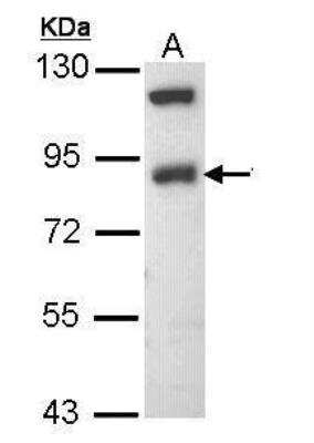 Western Blot: epithelial Sodium Channel beta Antibody [NBP1-33097] - Sample (30 ug of whole cell lysate)A: Raji7. 5% SDS PAGE, antibody diluted at 1:1000.