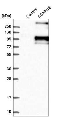 Western Blot: epithelial Sodium Channel beta Antibody [NBP1-84844] - Analysis in control (vector only transfected HEK293T lysate) and sCNN1B over-expression lysate (Co-expressed with a C-terminal myc-DDK tag (3.1 kDa) in mammalian HEK293T cells).