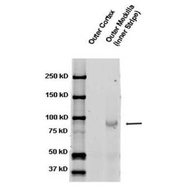 Western Blot epithelial Sodium Channel beta Antibody