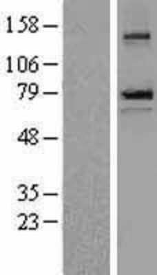 Western Blot: epithelial Sodium Channel beta Overexpression Lysate (Adult Normal) [NBL1-15746] Left-Empty vector transfected control cell lysate (HEK293 cell lysate); Right -Over-expression Lysate for epithelial Sodium Channel beta.