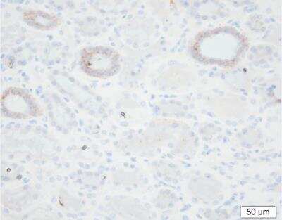 Immunohistochemistry-Paraffin: epithelial Sodium Channel gamma Antibody (5c2) [NBP2-41374] - Staining of Human kidney tissue. Courtesy of Per Svenningsen, PhD.