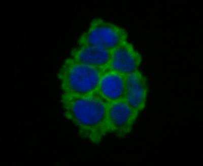 Immunocytochemistry/Immunofluorescence: epithelial Sodium Channel gamma Antibody [NBP2-76964] - ICC staining SCNN1G in 293T cells (green). The nuclear counter stain is DAPI (blue). Cells were fixed in paraformaldehyde, permeabilised with 0.25% Triton X100/PBS.
