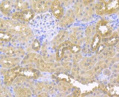 Immunohistochemistry: epithelial Sodium Channel gamma Antibody [NBP2-76964] - Immunohistochemical analysis of paraffin-embedded rat kidney tissue using anti-SCNN1G antibody. Counter stained with hematoxylin.