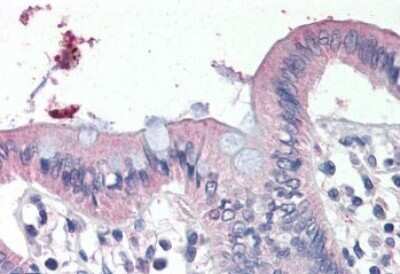 Immunohistochemistry-Paraffin: epithelial Sodium Channel gamma Antibody [NBP1-06075] - (4ug/ml) staining of paraffin embedded Human Colon. Steamed antigen retrieval with citrate buffer pH 6, AP-staining.