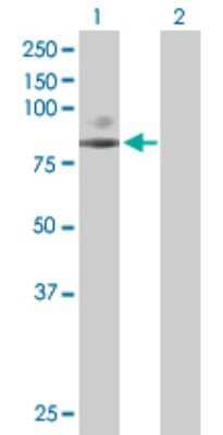 Western Blot: epithelial Sodium Channel gamma Antibody [H00006340-D01P] - Analysis of SCNN1G expression in transfected 293T cell line by SCNN1G polyclonal antibody.Lane 1: SCNN1G transfected lysate(74.30 KDa).Lane 2: Non-transfected lysate.
