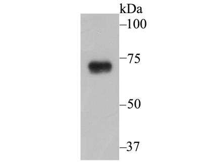 Western Blot: epithelial Sodium Channel gamma Antibody [NBP2-76964] - Western blot analysis of SCNN1G on A431 cell lysate using anti-SCNN1G antibody at 1/1,000 dilution.