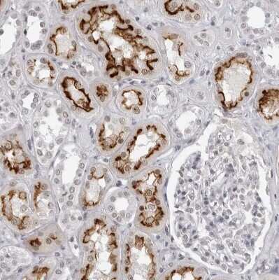 Immunohistochemistry-Paraffin espin Antibody