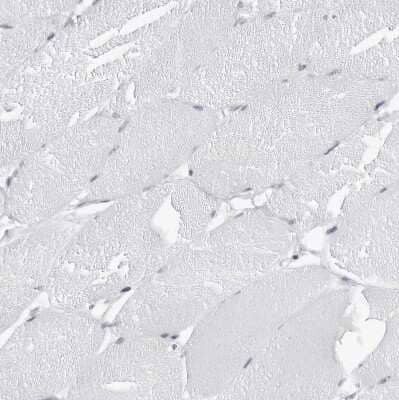 Immunohistochemistry-Paraffin espin Antibody