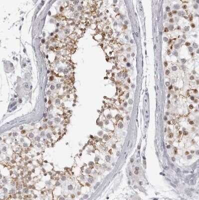 Immunohistochemistry-Paraffin: espin Antibody [NBP1-90588] - Staining of human testis shows moderate membranous positivity in cells in seminiferous ducts.