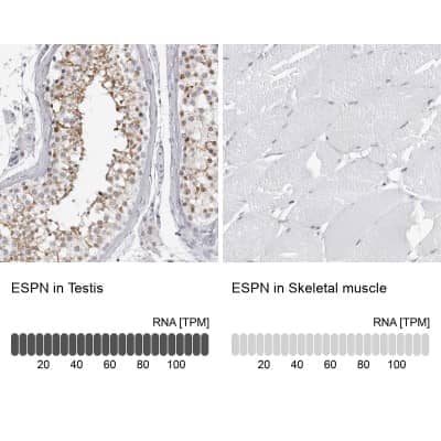 Immunohistochemistry-Paraffin: espin Antibody [NBP1-90588] - Staining in human testis and skeletal muscle tissues using NBP1-90588 antibody. Corresponding ESPN RNA-seq data are presented for the same tissues.