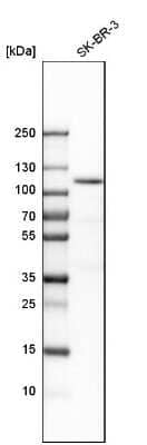 Western Blot: espin Antibody [NBP1-90588] - Analysis in human cell line SK-BR-3.