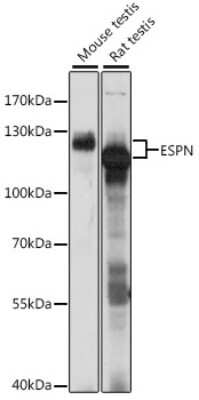 Western Blot: espin Antibody [NBP3-03768] - Analysis of extracts of various cell lines, using espin antibody at 1:1000 dilution. Secondary antibody: HRP Goat Anti-Rabbit IgG (H+L) at 1:10000 dilution. Lysates/proteins: 25ug per lane. Blocking buffer: 3% nonfat dry milk in TBST. Detection: ECL Basic Kit.