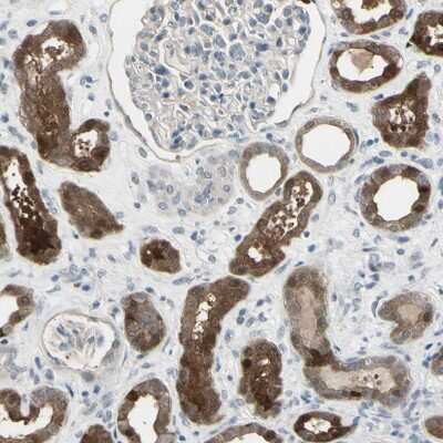 Immunohistochemistry-Paraffin: ethanolamine kinase Antibody [NBP2-33292] - Staining of human kidney shows cytoplasmic positivity in cells in tubules.