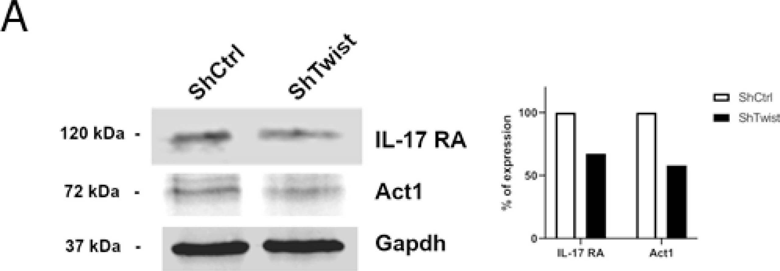 Evaluation of IL-17 signaling in TWIST1-knockdown BC cells compared to control cells. (A) Protein levels of Act1 and IL-17RA in ShCTRL and ShTWIST cells. GAPDH was used to ensure that the same sample amounts were loaded for immunoblotting. Densitometric analysis was done using ImageJ software. (B) Levels of secreted IL-6 and IL-8 proteins in the supernatant of ShCTRL and ShTWIST cells. Data are shown as the mean (±SD). * p < 0.05. Image collected and cropped by CiteAb from the following open publication (//pubmed.ncbi.nlm.nih.gov/34830027), licensed under a CC-BY license. Not internally tested by R&D Systems.