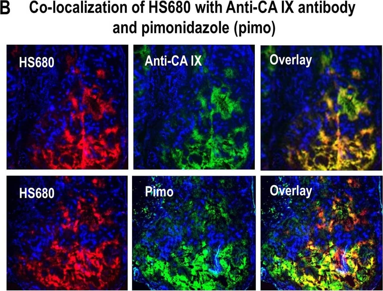 Localization of HS680 and tumor hypoxia markers in HeLa xenografts. A, The tissue staining patterns of the control agent, HS680, and HS680+AZ (red) from the same or adjacent tumor sections as staining with fluorescent CA IX antibody or pimonidazole (green) and the Hoechst perfusion stain (blue). H&E staining of tissue sections that were used for localization are shown on the left side of images. HS680 was specifically localized in regions with low Hoechst staining indicative of low oxygen (less perfused) but positive staining with both the CA IX antibody and Pimonidazole. Preinjection of the mice with unlabeled AZ blocked the binding of HS680 to control levels. B, Co-localization (overlay) of HS680 with CA IX antibody or pimonidazole (hypoxyprobe) is shown on the right side images indicating HS680 was clearly co-localized with both anti-CA IX antibody and hypoxyprobe (pimonidazole). Similar results were obtained using HT-29 tumors (Figure S4A and Figure S4B). Image collected and cropped by CiteAb from the following open publication (//pubmed.ncbi.nlm.nih.gov/23226406), licensed under a CC-BY license. Not internally tested by R&D Systems.