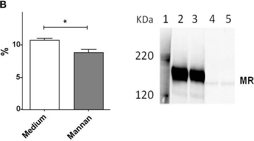 Addition of mannan decreases expression of MR on BMDCs. (A) Cell surface expression of MR measured by flow cytometry in BMDCs treated with medium (dashed line) or mannan (100 μg/mL, solid line) for 30 min prior to staining with PE-labeled anti-MR antibody. The percentages of MR positive cells (%) are depicted in the histogram. (B) Immune blotting: BMDCs were added with medium (lane 2 and 4) or mannan (100 μg/mL, lane 3 and 5), and after 1 h supernatants (lane 4 and 5) and lysed cells (lane 2 and 3) were analyzed for the content of MR by Western blotting. (C) FITC positive cells in BMDC pretreated with medium (dotted line) or mannan (black solid line) and then added with FITC-dextran were measured by flow cytometry. The mean fluorescence intensities (MFI) are depicted in the histogram. Data indicate mean ± SD of duplicates (*P < 0.05 and **P < 0.01). Image collected and cropped by CiteAb from the following open publication (//pubmed.ncbi.nlm.nih.gov/31803184), licensed under a CC-BY license. Not internally tested by R&D Systems.