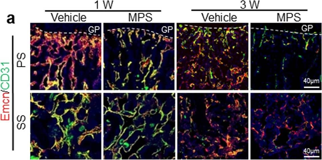 Antagonizing endothelial cell senescence improves GC-impaired bone angiogenesis and osteogenesis.a–i Three-week-old BALB/c mice were treated with MPS at 10 mg/m2/day or vehicle by daily intraperitoneal injection for 1 or 3 weeks. Double-immunofluorescence staining of femur metaphysis sections was performed using antibodies against Emcn (red) and CD31 (green) in (a). DAPI stains nuclei blue. Relative yellow fluorescence intensity (vessels expressing both Emcn and CD31) in primary spongiosa (b) and secondary spongiosa (c) was measured. Cells isolated from femoral metaphysis of MPS-treated or vehicle-treated mice were subjected to flow cytometry analysis. Representative images are shown in (d). Black circle: type-H vessels; Brown circle: type-L vascular cells. The percentages of the CD31hiEmcnhi cells and CD31loEmcnlo cells are shown in (e) and (f), respectively. Immunofluorescence staining of femoral metaphysis sections was performed using antibody against Osteocalcin (OCN, green) in (g). DAPI stains nuclei blue. Quantified numbers of OCN+ cells per mm2 tissue area (N. OCN+ cells/Ar) in primary spongiosa and secondary spongiosa are shown in (h) and (i), respectively. Image collected and cropped by CiteAb from the following open publication (//pubmed.ncbi.nlm.nih.gov/33758201), licensed under a CC-BY license. Not internally tested by R&D Systems.