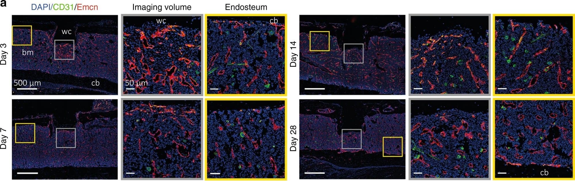 LIMB and immunofluorescence analysis indicate possible mechanisms of vascular morphological changes deep in the femoral bone marrow, during regeneration, and in steady-state homeostasis. a Immunofluorescence analysis shows that type H vessels, characterized by CD31hiEmcnhi-expressing endothelial cells, are induced and present around the implant at day 3 after LIMB implantation. Their presence may vary individually but normalizes within 28 days post-surgery. Sinusoidal and type H vessel morphology adjacent to the wc is irregular in the first week and completely reorganizes to an appearance comparable to vessels found at endosteal areas distant from the injury site (n = 3 mice). bm bone marrow, cb cortical bone. Scale bar = 500 µm (left panels). b Immunofluorescence analysis after EdU pulse-chase experiments indicates similar EdU-uptake in the bone marrow of LIMB-implanted femurs and contralateral bones. Proliferating endothelial cells were rarely present at late time points after implantation. This result also supports the conclusion that 28 days after LIMB implantation both the bone and the bone marrow reach homeostasis (n = 3 mice in each cohort). c 3D fluorescence image (300 × 300 × 66 µm3, left and right panel) acquired by LIMB 26 days post-surgery, in a paGFP mouse with the vasculature labeled by Qdots. Photoactivation was performed within a volume of 100 × 100 × 9 µm3 in the center of the image. The fluorescence image was acquired 2 h post activation. Scale bar = 50 µm. The middle panel shows time-lapse 3D images of the inset from the left panel, indicating that paGFP fluorescent cells outside the initial photoactivation volume are present 3 h after photoactivation and that they fluctuate in number and position within the tissue. Passive displacement of the relatively immobile stromal and vascular compartments by continuous proliferation and movement of hematopoietic cells is a possible mechanism of tissue and vascular re-localization during homeostasis (see Supplementary Movies 10, 11) Image collected and cropped by CiteAb from the following publication (//pubmed.ncbi.nlm.nih.gov/29255233), licensed under a CC-BY license. Not internally tested by R&D Systems.