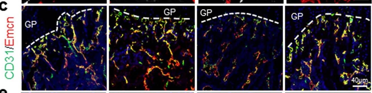 Recombinant human ANG (rhANG) rescues GC-impaired bone growth and mineral acquisition.Three-week-old BALB/c mice were treated with vehicle, MPS alone at 10 mg/m2/day or MPS plus rhANG (1 µg/day) by daily intraperitoneal injection for 4 weeks. Representative images of SA-beta Gal staining (white) and immunofluorescence staining of Endomucin (Emcn, red) in primary spongiosa of femoral bone in (a). Percentage of SA-beta Gal-expressing vessels were quantified in (b). Double immunofluorescence staining of Emcn (red) and CD31 (green) in metaphysis of femoral bone in (c). DAPI-stained nuclei blue. Relative yellow fluorescence intensity in primary spongiosa was measured in (d). Immunofluorescence staining of femoral metaphysis sections were performed using antibody against Osx (red) in (e). DAPI stains nuclei blue. Numbers of Osx+ cells per mm2 tissue area (N. Osx+ cells/Ar) were quantified in (f). Representative μCT images of distal femur in mice were shown in (g, longitudinal sections) and (h, cross sections). Quantitative analyses of trabecular bone volume fraction (BV/TV) (i), trabecular thickness (Tb. Th) (j), trabecular number (Tb. N) (k), and trabecular separation (Tb.Sp) (l). Trichrome staining of the metaphyseal trabecular bone at distal femora in (m). Osteoid stains red and mineralized bone stains green. Osteoid surface per bone surface (OS/BS) was measured in (n). Representative images of calcein double labeling (o) and quantification of bone formation rate per bone surface (BFR/BS) (p) of the metaphyseal trabecular bone at distal femora. GP growth plate. n = 6-10 mice. Data are represented as mean ± s.e.m. **p < 0.01 as determined by one-way ANOVA with post hoc Tukey test. Image collected and cropped by CiteAb from the following open publication (//pubmed.ncbi.nlm.nih.gov/33758201), licensed under a CC-BY license. Not internally tested by R&D Systems.