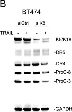 Knockdown of K8 enhances TRAIL induced apoptosis(A-C) Cells were transfected with a control siRNA or siRNA specific to KRT8 transcript for 72 hours, followed by TRAIL stimulation (100 ng/ml [T47D and BT474] or 150 ng/ml [MCF7]) for 24 hours. The resultant cells were analyzed by immunoblotting using antibodies specific to K8/K18, DR4, DR5, caspase-3, caspase-8, and glyceraldehyde 3-phosphate dehydrogenase (GAPDH). Caspase activation was identified by decrease in pro-enzyme form (ProC-8 and ProC-3). (D-F) Cells were treated as above and analyzed by flow cytometry after staining with Annexin-V-FITC and propidium iodide (PI). Image collected and cropped by CiteAb from the following open publication (//pubmed.ncbi.nlm.nih.gov/29796187), licensed under a CC-BY license. Not internally tested by R&D Systems.