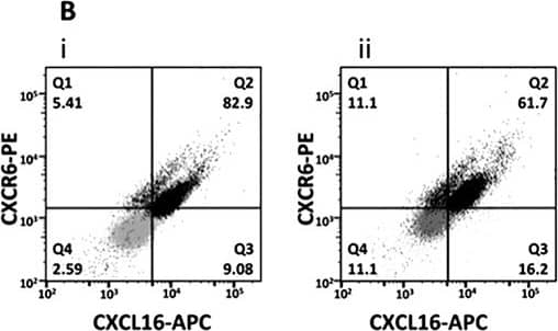 CXCR6 and CXCL16 expression in LuCa cell lines(A) mRNA levels by semiquantitative RT-PCR. The copies of CXCR6 and CXCL16 transcripts are expressed relative to copies of 18S rRNA. Values are mean ± SEM from 3 independent experiments. *p ≤ 0.05, ***p ≤ 0.001 as compared to SCC (NCI-H520). (B) Flow cytometry analysis of CXCR6 and trans-membrane CXCL16 in (i) - SCC (NCI-H520) cells and (ii) - AC (NCI-H2126) cells. Grey dots represent isotype controls for PE and APC antibody and black dots represent CXCR6-PE and CXCL16-APC in SCC (NCI-H520) and AC (NCI-H2126). CXCR6 and CXCL16 both are expressed on ~82.9% (Q2) SCC cells; 5.41% (Q1) express only CXCR6 and only CXCL16 is expressed by 9.08% (Q3) of SCC cells. In AC cells, 61.7% of the population express both receptor and ligand (Q2) whereas, 11.1 (Q1) and 16.2% (Q3) cells express only CXCR6 and CXCL16, respectively. c) Levels of soluble CXCL16 in LuCa supernatant. Values are mean ± SEM from 3 independent experiments. ***p ≤ 0.0001 compared to NCI-H520. Image collected and cropped by CiteAb from the following publication (//www.oncotarget.com/lookup/doi/10.18632/oncotarget.3194), licensed under a CC-BY license. Not internally tested by R&D Systems.