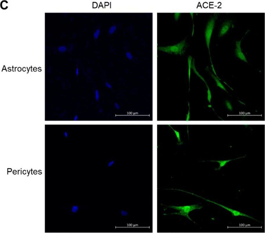 (A) Expression of ACE-2 receptor on human brain Astrocytes and Pericytes as analyzed by Flow cytometry; (B) Percentage of Astrocytes, Pericytes and Vero E6 cells expressing ACE-2 receptor and (C) “in situ immunostaining” of Astrocytes and Pericytes. Blue color represents DAPI bound to nuclei and the green color represents cell surface ACE-2 expression. Image collected and cropped by CiteAb from the following open publication (//pubmed.ncbi.nlm.nih.gov/37239978), licensed under a CC-BY license. Not internally tested by R&D Systems.