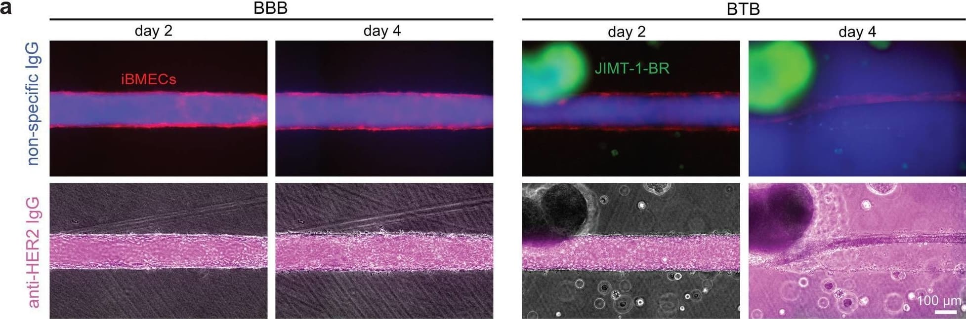 Antibody permeability and accumulation dynamics within an in vitro metastatic blood-tumor barrier model. a Representative images of antibody permeability with and without cancer cells. Images are at 30 min after perfusion with non-specific or anti-HER2 IgG in BBB and BTB microvessels. iBMECs (red), non-specific IgG (blue), anti-HER2 IgG (magenta), JIMT-1-BR (green). b Quantification of focal leaks between BBB and BTB microvessels over time (n = 4–5 independent microvessels per condition). c Representative images of antibody accumulation within the BBB and BTB at day 4. Images are normalized to day 2 fluorescence. d Quantification of antibody accumulation across BBB endothelium, BTB endothelium, and cancer spheroids (n = 4 independent microvessels per condition). Data are presented as mean ± SD. *p < 0.05. See also Additional file 1: Fig. S2 Image collected and cropped by CiteAb from the following open publication (//pubmed.ncbi.nlm.nih.gov/37924145), licensed under a CC-BY license. Not internally tested by R&D Systems.