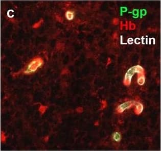 Neurovascular unit component expression in leaked versus non-leaked vessels along the spinal cord axis. Immunohistochemical labelling of neurovascular unit markers in ALS spinal cord (a–l); tight junctions claudin-5 (a, g) and ZO-1 (b, h), efflux pump P-glycoprotein (c, i), basement membrane marker collagen IV (d, j), and astrocyte markers aquaporin 4 (e, k) and GFAP (f, l), in spinal cord vessels with or without hemoglobin leakage. Scale bar = 50 µm. Automated quantification of average intensity staining of neurovascular unit markers was carried out in all ALS cases (n = 13) or in a subset of ALS cases with high hemoglobin leakage (n = 5) in leaked and non-leaked areas of the white and gray matter of the spinal cord (m–r). Composite of original images showing anti-hemoglobin immunoreactivity (red) and lectin-positive vessels (green) (m) and overlays of hemoglobin leakage analysis output (white, partly transparent) over anti-hemoglobin (red) (n). Segmentation of vessels inside (magenta) or outside (white) areas of hemoglobin leakage in the white matter (o) or gray matter (p). Dashed lines show boundaries. Scale bar = 1 mm. Perivascular astrocyte endfeet staining (green) around lectin-positive vessels (white) in (q) was isolated using an automated mask of the glia limitans (r). Scale bar = 50 µm. The average intensities of marker staining were measured in leaked and non-leaked vessels of the gray and white matter (s–x). Data shown as mean ± SD (n = 5 or 13) with statistical significance determined with a two-way repeated-measures ANOVA with Sidak’s post-test. ns = not significant Image collected and cropped by CiteAb from the following open publication (//pubmed.ncbi.nlm.nih.gov/34446086), licensed under a CC-BY license. Not internally tested by R&D Systems.