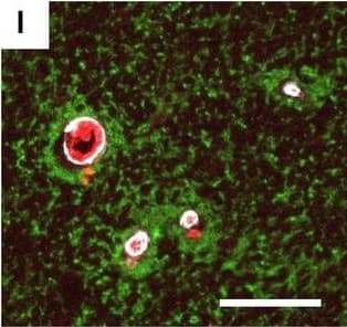 Neurovascular unit component expression in leaked versus non-leaked vessels along the spinal cord axis. Immunohistochemical labelling of neurovascular unit markers in ALS spinal cord (a–l); tight junctions claudin-5 (a, g) and ZO-1 (b, h), efflux pump P-glycoprotein (c, i), basement membrane marker collagen IV (d, j), and astrocyte markers aquaporin 4 (e, k) and GFAP (f, l), in spinal cord vessels with or without hemoglobin leakage. Scale bar = 50 µm. Automated quantification of average intensity staining of neurovascular unit markers was carried out in all ALS cases (n = 13) or in a subset of ALS cases with high hemoglobin leakage (n = 5) in leaked and non-leaked areas of the white and gray matter of the spinal cord (m–r). Composite of original images showing anti-hemoglobin immunoreactivity (red) and lectin-positive vessels (green) (m) and overlays of hemoglobin leakage analysis output (white, partly transparent) over anti-hemoglobin (red) (n). Segmentation of vessels inside (magenta) or outside (white) areas of hemoglobin leakage in the white matter (o) or gray matter (p). Dashed lines show boundaries. Scale bar = 1 mm. Perivascular astrocyte endfeet staining (green) around lectin-positive vessels (white) in (q) was isolated using an automated mask of the glia limitans (r). Scale bar = 50 µm. The average intensities of marker staining were measured in leaked and non-leaked vessels of the gray and white matter (s–x). Data shown as mean ± SD (n = 5 or 13) with statistical significance determined with a two-way repeated-measures ANOVA with Sidak’s post-test. ns = not significant Image collected and cropped by CiteAb from the following open publication (//pubmed.ncbi.nlm.nih.gov/34446086), licensed under a CC-BY license. Not internally tested by R&D Systems.