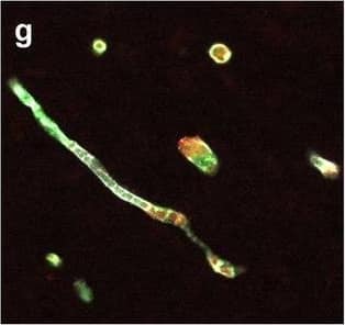 Neurovascular unit component expression in leaked versus non-leaked vessels along the spinal cord axis. Immunohistochemical labelling of neurovascular unit markers in ALS spinal cord (a–l); tight junctions claudin-5 (a, g) and ZO-1 (b, h), efflux pump P-glycoprotein (c, i), basement membrane marker collagen IV (d, j), and astrocyte markers aquaporin 4 (e, k) and GFAP (f, l), in spinal cord vessels with or without hemoglobin leakage. Scale bar = 50 µm. Automated quantification of average intensity staining of neurovascular unit markers was carried out in all ALS cases (n = 13) or in a subset of ALS cases with high hemoglobin leakage (n = 5) in leaked and non-leaked areas of the white and gray matter of the spinal cord (m–r). Composite of original images showing anti-hemoglobin immunoreactivity (red) and lectin-positive vessels (green) (m) and overlays of hemoglobin leakage analysis output (white, partly transparent) over anti-hemoglobin (red) (n). Segmentation of vessels inside (magenta) or outside (white) areas of hemoglobin leakage in the white matter (o) or gray matter (p). Dashed lines show boundaries. Scale bar = 1 mm. Perivascular astrocyte endfeet staining (green) around lectin-positive vessels (white) in (q) was isolated using an automated mask of the glia limitans (r). Scale bar = 50 µm. The average intensities of marker staining were measured in leaked and non-leaked vessels of the gray and white matter (s–x). Data shown as mean ± SD (n = 5 or 13) with statistical significance determined with a two-way repeated-measures ANOVA with Sidak’s post-test. ns = not significant Image collected and cropped by CiteAb from the following open publication (//pubmed.ncbi.nlm.nih.gov/34446086), licensed under a CC-BY license. Not internally tested by R&D Systems.