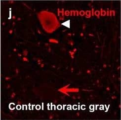 Hemoglobin localization in control and ALS spinal cord. Immunohistochemical staining of hemoglobin extravasation in cervical white matter from control (a–c) or ALS (d–f) spinal cord. Hemoglobin immunoreactivity (red) and lectin-positive vessels (green) are shown with a Hoechst nuclear counterstain (blue). Scale bars = 50 µm. Representative images of full spinal cord sections from the cervical level of a control case with no hemoglobin leakage (g), the thoracic level of an ALS case with white matter hemoglobin leakage (h), and the lumbar level of an ALS case with gray matter hemoglobin leakage (i) are shown. Dashed lines show gray matter boundary; scale bar = 1 mm. Occasional hemoglobin staining of SMI-32-positive anterior horn motor neurons was also observed (j–m). White arrowhead indicates a SMI-32-positive hemoglobin-positive motor neuron, where the red arrow indicates an SMI-32-positive hemoglobin-negative motor neuron. Scale bars = 50 µm Image collected and cropped by CiteAb from the following open publication (//pubmed.ncbi.nlm.nih.gov/34446086), licensed under a CC-BY license. Not internally tested by R&D Systems.