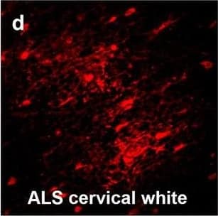 Hemoglobin localization in control and ALS spinal cord. Immunohistochemical staining of hemoglobin extravasation in cervical white matter from control (a–c) or ALS (d–f) spinal cord. Hemoglobin immunoreactivity (red) and lectin-positive vessels (green) are shown with a Hoechst nuclear counterstain (blue). Scale bars = 50 µm. Representative images of full spinal cord sections from the cervical level of a control case with no hemoglobin leakage (g), the thoracic level of an ALS case with white matter hemoglobin leakage (h), and the lumbar level of an ALS case with gray matter hemoglobin leakage (i) are shown. Dashed lines show gray matter boundary; scale bar = 1 mm. Occasional hemoglobin staining of SMI-32-positive anterior horn motor neurons was also observed (j–m). White arrowhead indicates a SMI-32-positive hemoglobin-positive motor neuron, where the red arrow indicates an SMI-32-positive hemoglobin-negative motor neuron. Scale bars = 50 µm Image collected and cropped by CiteAb from the following open publication (//pubmed.ncbi.nlm.nih.gov/34446086), licensed under a CC-BY license. Not internally tested by R&D Systems.