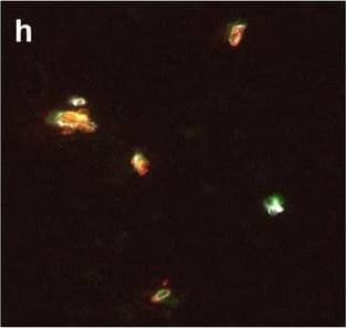 Neurovascular unit component expression in leaked versus non-leaked vessels along the spinal cord axis. Immunohistochemical labelling of neurovascular unit markers in ALS spinal cord (a–l); tight junctions claudin-5 (a, g) and ZO-1 (b, h), efflux pump P-glycoprotein (c, i), basement membrane marker collagen IV (d, j), and astrocyte markers aquaporin 4 (e, k) and GFAP (f, l), in spinal cord vessels with or without hemoglobin leakage. Scale bar = 50 µm. Automated quantification of average intensity staining of neurovascular unit markers was carried out in all ALS cases (n = 13) or in a subset of ALS cases with high hemoglobin leakage (n = 5) in leaked and non-leaked areas of the white and gray matter of the spinal cord (m–r). Composite of original images showing anti-hemoglobin immunoreactivity (red) and lectin-positive vessels (green) (m) and overlays of hemoglobin leakage analysis output (white, partly transparent) over anti-hemoglobin (red) (n). Segmentation of vessels inside (magenta) or outside (white) areas of hemoglobin leakage in the white matter (o) or gray matter (p). Dashed lines show boundaries. Scale bar = 1 mm. Perivascular astrocyte endfeet staining (green) around lectin-positive vessels (white) in (q) was isolated using an automated mask of the glia limitans (r). Scale bar = 50 µm. The average intensities of marker staining were measured in leaked and non-leaked vessels of the gray and white matter (s–x). Data shown as mean ± SD (n = 5 or 13) with statistical significance determined with a two-way repeated-measures ANOVA with Sidak’s post-test. ns = not significant Image collected and cropped by CiteAb from the following open publication (//pubmed.ncbi.nlm.nih.gov/34446086), licensed under a CC-BY license. Not internally tested by R&D Systems.