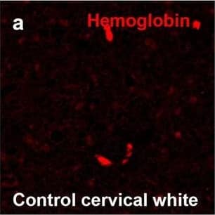 Hemoglobin localization in control and ALS spinal cord. Immunohistochemical staining of hemoglobin extravasation in cervical white matter from control (a–c) or ALS (d–f) spinal cord. Hemoglobin immunoreactivity (red) and lectin-positive vessels (green) are shown with a Hoechst nuclear counterstain (blue). Scale bars = 50 µm. Representative images of full spinal cord sections from the cervical level of a control case with no hemoglobin leakage (g), the thoracic level of an ALS case with white matter hemoglobin leakage (h), and the lumbar level of an ALS case with gray matter hemoglobin leakage (i) are shown. Dashed lines show gray matter boundary; scale bar = 1 mm. Occasional hemoglobin staining of SMI-32-positive anterior horn motor neurons was also observed (j–m). White arrowhead indicates a SMI-32-positive hemoglobin-positive motor neuron, where the red arrow indicates an SMI-32-positive hemoglobin-negative motor neuron. Scale bars = 50 µm Image collected and cropped by CiteAb from the following open publication (//pubmed.ncbi.nlm.nih.gov/34446086), licensed under a CC-BY license. Not internally tested by R&D Systems.