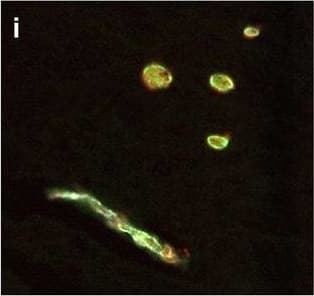 Immunohistochemistry Hemoglobin Antibody [Unconjugated]