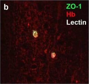 Neurovascular unit component expression in leaked versus non-leaked vessels along the spinal cord axis. Immunohistochemical labelling of neurovascular unit markers in ALS spinal cord (a–l); tight junctions claudin-5 (a, g) and ZO-1 (b, h), efflux pump P-glycoprotein (c, i), basement membrane marker collagen IV (d, j), and astrocyte markers aquaporin 4 (e, k) and GFAP (f, l), in spinal cord vessels with or without hemoglobin leakage. Scale bar = 50 µm. Automated quantification of average intensity staining of neurovascular unit markers was carried out in all ALS cases (n = 13) or in a subset of ALS cases with high hemoglobin leakage (n = 5) in leaked and non-leaked areas of the white and gray matter of the spinal cord (m–r). Composite of original images showing anti-hemoglobin immunoreactivity (red) and lectin-positive vessels (green) (m) and overlays of hemoglobin leakage analysis output (white, partly transparent) over anti-hemoglobin (red) (n). Segmentation of vessels inside (magenta) or outside (white) areas of hemoglobin leakage in the white matter (o) or gray matter (p). Dashed lines show boundaries. Scale bar = 1 mm. Perivascular astrocyte endfeet staining (green) around lectin-positive vessels (white) in (q) was isolated using an automated mask of the glia limitans (r). Scale bar = 50 µm. The average intensities of marker staining were measured in leaked and non-leaked vessels of the gray and white matter (s–x). Data shown as mean ± SD (n = 5 or 13) with statistical significance determined with a two-way repeated-measures ANOVA with Sidak’s post-test. ns = not significant Image collected and cropped by CiteAb from the following open publication (//pubmed.ncbi.nlm.nih.gov/34446086), licensed under a CC-BY license. Not internally tested by R&D Systems.