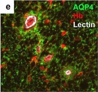 Neurovascular unit component expression in leaked versus non-leaked vessels along the spinal cord axis. Immunohistochemical labelling of neurovascular unit markers in ALS spinal cord (a–l); tight junctions claudin-5 (a, g) and ZO-1 (b, h), efflux pump P-glycoprotein (c, i), basement membrane marker collagen IV (d, j), and astrocyte markers aquaporin 4 (e, k) and GFAP (f, l), in spinal cord vessels with or without hemoglobin leakage. Scale bar = 50 µm. Automated quantification of average intensity staining of neurovascular unit markers was carried out in all ALS cases (n = 13) or in a subset of ALS cases with high hemoglobin leakage (n = 5) in leaked and non-leaked areas of the white and gray matter of the spinal cord (m–r). Composite of original images showing anti-hemoglobin immunoreactivity (red) and lectin-positive vessels (green) (m) and overlays of hemoglobin leakage analysis output (white, partly transparent) over anti-hemoglobin (red) (n). Segmentation of vessels inside (magenta) or outside (white) areas of hemoglobin leakage in the white matter (o) or gray matter (p). Dashed lines show boundaries. Scale bar = 1 mm. Perivascular astrocyte endfeet staining (green) around lectin-positive vessels (white) in (q) was isolated using an automated mask of the glia limitans (r). Scale bar = 50 µm. The average intensities of marker staining were measured in leaked and non-leaked vessels of the gray and white matter (s–x). Data shown as mean ± SD (n = 5 or 13) with statistical significance determined with a two-way repeated-measures ANOVA with Sidak’s post-test. ns = not significant Image collected and cropped by CiteAb from the following open publication (//pubmed.ncbi.nlm.nih.gov/34446086), licensed under a CC-BY license. Not internally tested by R&D Systems.