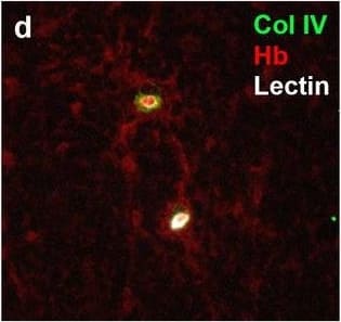 Neurovascular unit component expression in leaked versus non-leaked vessels along the spinal cord axis. Immunohistochemical labelling of neurovascular unit markers in ALS spinal cord (a–l); tight junctions claudin-5 (a, g) and ZO-1 (b, h), efflux pump P-glycoprotein (c, i), basement membrane marker collagen IV (d, j), and astrocyte markers aquaporin 4 (e, k) and GFAP (f, l), in spinal cord vessels with or without hemoglobin leakage. Scale bar = 50 µm. Automated quantification of average intensity staining of neurovascular unit markers was carried out in all ALS cases (n = 13) or in a subset of ALS cases with high hemoglobin leakage (n = 5) in leaked and non-leaked areas of the white and gray matter of the spinal cord (m–r). Composite of original images showing anti-hemoglobin immunoreactivity (red) and lectin-positive vessels (green) (m) and overlays of hemoglobin leakage analysis output (white, partly transparent) over anti-hemoglobin (red) (n). Segmentation of vessels inside (magenta) or outside (white) areas of hemoglobin leakage in the white matter (o) or gray matter (p). Dashed lines show boundaries. Scale bar = 1 mm. Perivascular astrocyte endfeet staining (green) around lectin-positive vessels (white) in (q) was isolated using an automated mask of the glia limitans (r). Scale bar = 50 µm. The average intensities of marker staining were measured in leaked and non-leaked vessels of the gray and white matter (s–x). Data shown as mean ± SD (n = 5 or 13) with statistical significance determined with a two-way repeated-measures ANOVA with Sidak’s post-test. ns = not significant Image collected and cropped by CiteAb from the following open publication (//pubmed.ncbi.nlm.nih.gov/34446086), licensed under a CC-BY license. Not internally tested by R&D Systems.