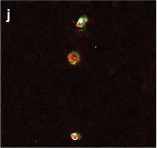 Neurovascular unit component expression in leaked versus non-leaked vessels along the spinal cord axis. Immunohistochemical labelling of neurovascular unit markers in ALS spinal cord (a–l); tight junctions claudin-5 (a, g) and ZO-1 (b, h), efflux pump P-glycoprotein (c, i), basement membrane marker collagen IV (d, j), and astrocyte markers aquaporin 4 (e, k) and GFAP (f, l), in spinal cord vessels with or without hemoglobin leakage. Scale bar = 50 µm. Automated quantification of average intensity staining of neurovascular unit markers was carried out in all ALS cases (n = 13) or in a subset of ALS cases with high hemoglobin leakage (n = 5) in leaked and non-leaked areas of the white and gray matter of the spinal cord (m–r). Composite of original images showing anti-hemoglobin immunoreactivity (red) and lectin-positive vessels (green) (m) and overlays of hemoglobin leakage analysis output (white, partly transparent) over anti-hemoglobin (red) (n). Segmentation of vessels inside (magenta) or outside (white) areas of hemoglobin leakage in the white matter (o) or gray matter (p). Dashed lines show boundaries. Scale bar = 1 mm. Perivascular astrocyte endfeet staining (green) around lectin-positive vessels (white) in (q) was isolated using an automated mask of the glia limitans (r). Scale bar = 50 µm. The average intensities of marker staining were measured in leaked and non-leaked vessels of the gray and white matter (s–x). Data shown as mean ± SD (n = 5 or 13) with statistical significance determined with a two-way repeated-measures ANOVA with Sidak’s post-test. ns = not significant Image collected and cropped by CiteAb from the following open publication (//pubmed.ncbi.nlm.nih.gov/34446086), licensed under a CC-BY license. Not internally tested by R&D Systems.