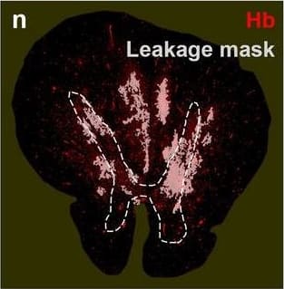 Neurovascular unit component expression in leaked versus non-leaked vessels along the spinal cord axis. Immunohistochemical labelling of neurovascular unit markers in ALS spinal cord (a–l); tight junctions claudin-5 (a, g) and ZO-1 (b, h), efflux pump P-glycoprotein (c, i), basement membrane marker collagen IV (d, j), and astrocyte markers aquaporin 4 (e, k) and GFAP (f, l), in spinal cord vessels with or without hemoglobin leakage. Scale bar = 50 µm. Automated quantification of average intensity staining of neurovascular unit markers was carried out in all ALS cases (n = 13) or in a subset of ALS cases with high hemoglobin leakage (n = 5) in leaked and non-leaked areas of the white and gray matter of the spinal cord (m–r). Composite of original images showing anti-hemoglobin immunoreactivity (red) and lectin-positive vessels (green) (m) and overlays of hemoglobin leakage analysis output (white, partly transparent) over anti-hemoglobin (red) (n). Segmentation of vessels inside (magenta) or outside (white) areas of hemoglobin leakage in the white matter (o) or gray matter (p). Dashed lines show boundaries. Scale bar = 1 mm. Perivascular astrocyte endfeet staining (green) around lectin-positive vessels (white) in (q) was isolated using an automated mask of the glia limitans (r). Scale bar = 50 µm. The average intensities of marker staining were measured in leaked and non-leaked vessels of the gray and white matter (s–x). Data shown as mean ± SD (n = 5 or 13) with statistical significance determined with a two-way repeated-measures ANOVA with Sidak’s post-test. ns = not significant Image collected and cropped by CiteAb from the following open publication (//pubmed.ncbi.nlm.nih.gov/34446086), licensed under a CC-BY license. Not internally tested by R&D Systems.