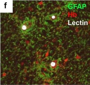 Neurovascular unit component expression in leaked versus non-leaked vessels along the spinal cord axis. Immunohistochemical labelling of neurovascular unit markers in ALS spinal cord (a–l); tight junctions claudin-5 (a, g) and ZO-1 (b, h), efflux pump P-glycoprotein (c, i), basement membrane marker collagen IV (d, j), and astrocyte markers aquaporin 4 (e, k) and GFAP (f, l), in spinal cord vessels with or without hemoglobin leakage. Scale bar = 50 µm. Automated quantification of average intensity staining of neurovascular unit markers was carried out in all ALS cases (n = 13) or in a subset of ALS cases with high hemoglobin leakage (n = 5) in leaked and non-leaked areas of the white and gray matter of the spinal cord (m–r). Composite of original images showing anti-hemoglobin immunoreactivity (red) and lectin-positive vessels (green) (m) and overlays of hemoglobin leakage analysis output (white, partly transparent) over anti-hemoglobin (red) (n). Segmentation of vessels inside (magenta) or outside (white) areas of hemoglobin leakage in the white matter (o) or gray matter (p). Dashed lines show boundaries. Scale bar = 1 mm. Perivascular astrocyte endfeet staining (green) around lectin-positive vessels (white) in (q) was isolated using an automated mask of the glia limitans (r). Scale bar = 50 µm. The average intensities of marker staining were measured in leaked and non-leaked vessels of the gray and white matter (s–x). Data shown as mean ± SD (n = 5 or 13) with statistical significance determined with a two-way repeated-measures ANOVA with Sidak’s post-test. ns = not significant Image collected and cropped by CiteAb from the following open publication (//pubmed.ncbi.nlm.nih.gov/34446086), licensed under a CC-BY license. Not internally tested by R&D Systems.