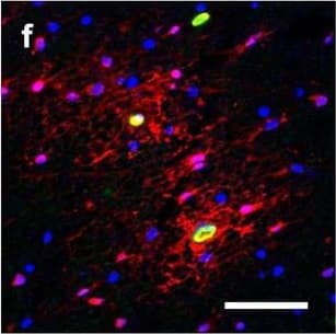 Hemoglobin localization in control and ALS spinal cord. Immunohistochemical staining of hemoglobin extravasation in cervical white matter from control (a–c) or ALS (d–f) spinal cord. Hemoglobin immunoreactivity (red) and lectin-positive vessels (green) are shown with a Hoechst nuclear counterstain (blue). Scale bars = 50 µm. Representative images of full spinal cord sections from the cervical level of a control case with no hemoglobin leakage (g), the thoracic level of an ALS case with white matter hemoglobin leakage (h), and the lumbar level of an ALS case with gray matter hemoglobin leakage (i) are shown. Dashed lines show gray matter boundary; scale bar = 1 mm. Occasional hemoglobin staining of SMI-32-positive anterior horn motor neurons was also observed (j–m). White arrowhead indicates a SMI-32-positive hemoglobin-positive motor neuron, where the red arrow indicates an SMI-32-positive hemoglobin-negative motor neuron. Scale bars = 50 µm Image collected and cropped by CiteAb from the following open publication (//pubmed.ncbi.nlm.nih.gov/34446086), licensed under a CC-BY license. Not internally tested by R&D Systems.