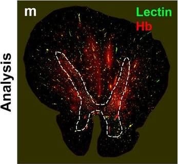 Neurovascular unit component expression in leaked versus non-leaked vessels along the spinal cord axis. Immunohistochemical labelling of neurovascular unit markers in ALS spinal cord (a–l); tight junctions claudin-5 (a, g) and ZO-1 (b, h), efflux pump P-glycoprotein (c, i), basement membrane marker collagen IV (d, j), and astrocyte markers aquaporin 4 (e, k) and GFAP (f, l), in spinal cord vessels with or without hemoglobin leakage. Scale bar = 50 µm. Automated quantification of average intensity staining of neurovascular unit markers was carried out in all ALS cases (n = 13) or in a subset of ALS cases with high hemoglobin leakage (n = 5) in leaked and non-leaked areas of the white and gray matter of the spinal cord (m–r). Composite of original images showing anti-hemoglobin immunoreactivity (red) and lectin-positive vessels (green) (m) and overlays of hemoglobin leakage analysis output (white, partly transparent) over anti-hemoglobin (red) (n). Segmentation of vessels inside (magenta) or outside (white) areas of hemoglobin leakage in the white matter (o) or gray matter (p). Dashed lines show boundaries. Scale bar = 1 mm. Perivascular astrocyte endfeet staining (green) around lectin-positive vessels (white) in (q) was isolated using an automated mask of the glia limitans (r). Scale bar = 50 µm. The average intensities of marker staining were measured in leaked and non-leaked vessels of the gray and white matter (s–x). Data shown as mean ± SD (n = 5 or 13) with statistical significance determined with a two-way repeated-measures ANOVA with Sidak’s post-test. ns = not significant Image collected and cropped by CiteAb from the following open publication (//pubmed.ncbi.nlm.nih.gov/34446086), licensed under a CC-BY license. Not internally tested by R&D Systems.