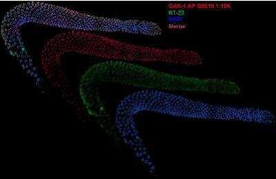 Immunocytochemistry/Immunofluorescence: gak-1 Antibody [29460002] - This image is specific to animal number SDQ0815  1:10000 Affinity Purified, 1:2000 Serum