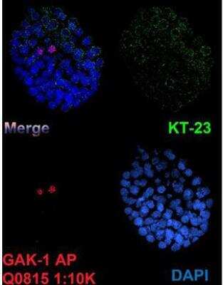 Immunocytochemistry/Immunofluorescence: gak-1 Antibody [29460002] - This image is specific to animal number SDQ0815 1:10000 Affinity Purified, 1:2000 Serum