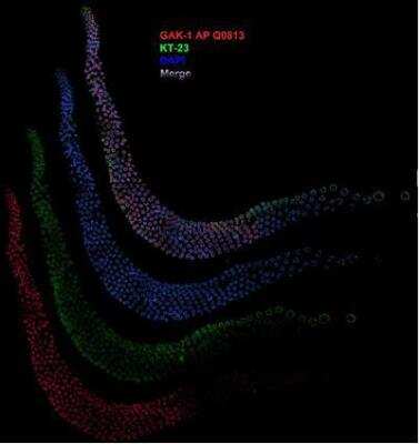 Immunocytochemistry/Immunofluorescence: gak-1 Antibody [29460002] - This image is specific to animal number SDQ0813 1:10000 Affinithy Purified