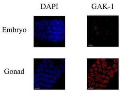 Immunocytochemistry/Immunofluorescence: gak-1 Antibody [29460002] - This image is specific to animal number SDQ0813  1:10000 Affinity Purified, 1:2000 Serum