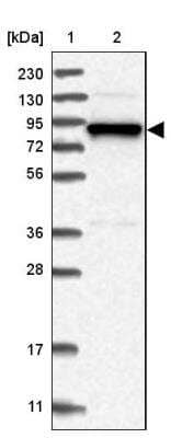 Western Blot gamma Adducin Antibody